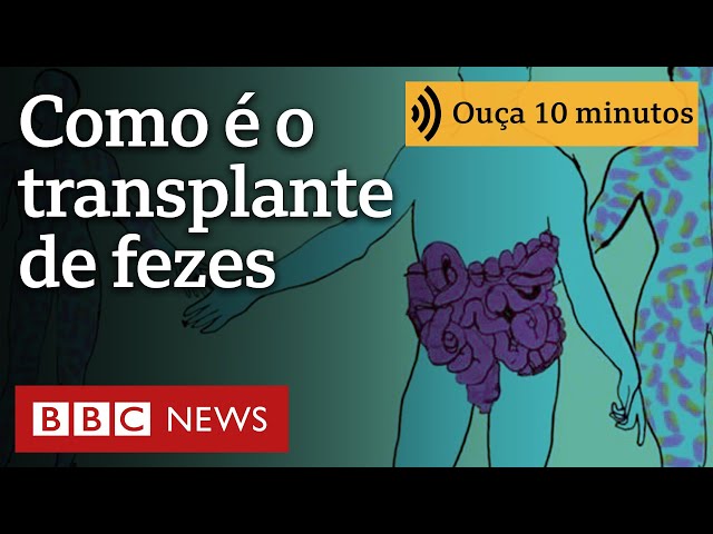 ⁣'Achei que era piada, mas me curou': como é o transplante de fezes, que Brasil estuda regu