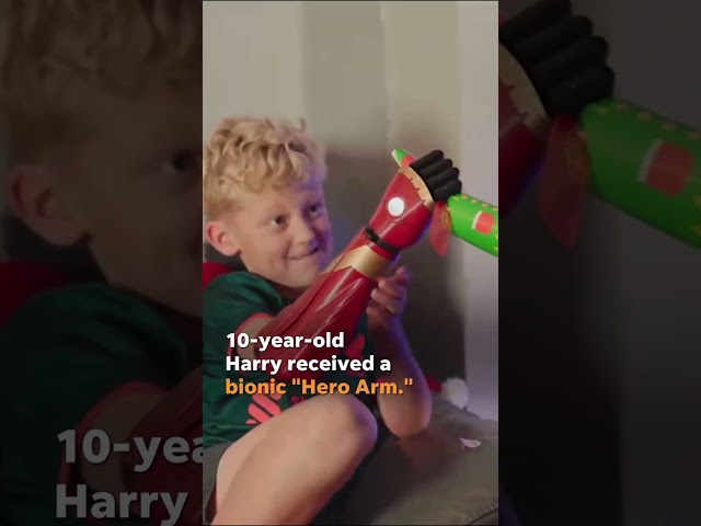 Boy born without lower part of his arm gifted bionic arm for Christmas #Shorts