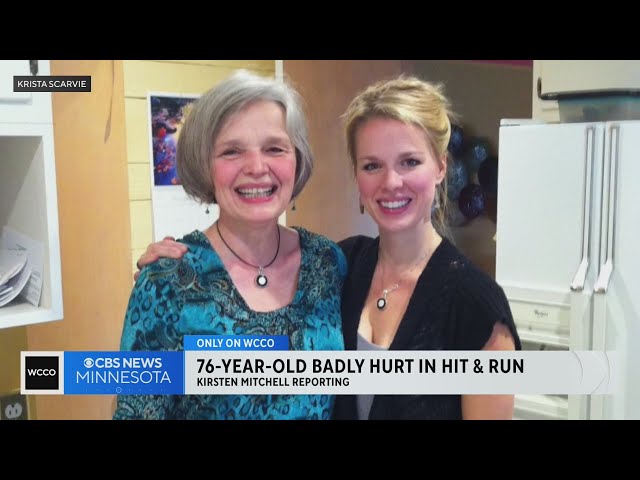 Family seeks answers in hit-and-run that left 76-year-old seriously hurt