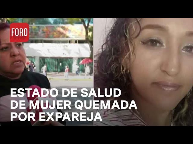 Karina Fuentes sufrió graves quemaduras - Las Noticias