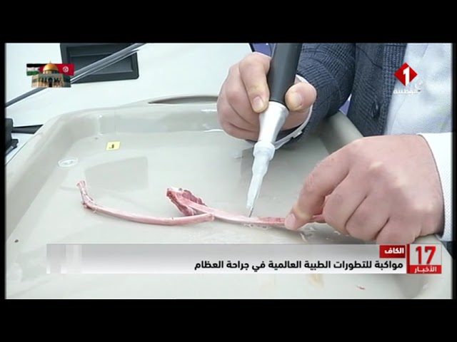 الكاف : مواكبة للتطورات الطبية العالمية في جراحة العظام