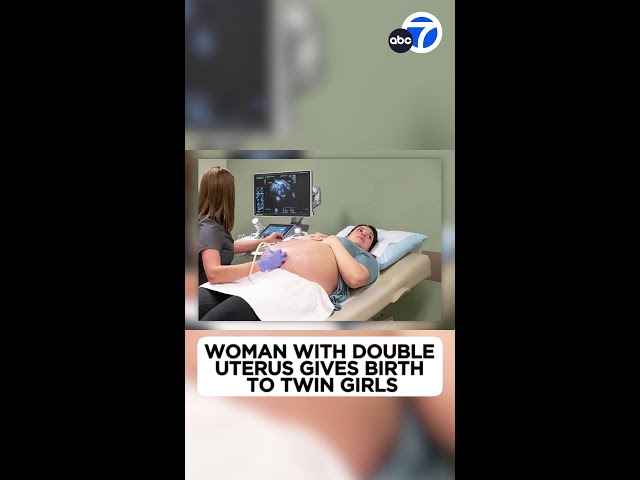 Woman with double uterus gives birth to twin girls