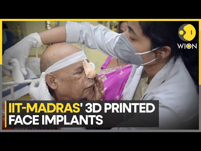 IIT Madras researchers develop 3D printed face implants for Black Fungus patients | WION