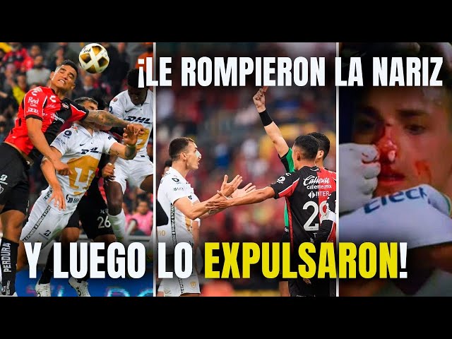  El día que a Dinenno le ROMPIERON la nariz, y luego lo EXPULSARON | TUDN