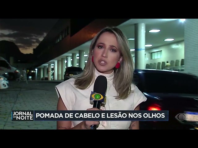 Mais de 100 pessoas são levadas a hospital por uso de pomada de cabelo