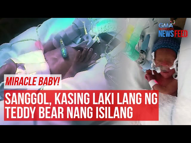 ⁣MIRACLE BABY! Sanggol, kasing laki lang ng teddy bear nang isilang | GMA Integrated Newsfeed