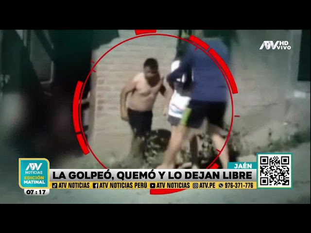 Mujer es golpeada y quemada por su ex y su nueva pareja