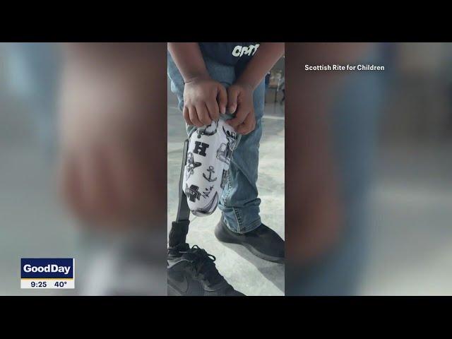 Young fan gets Dak's tattoos on his prosthetic leg