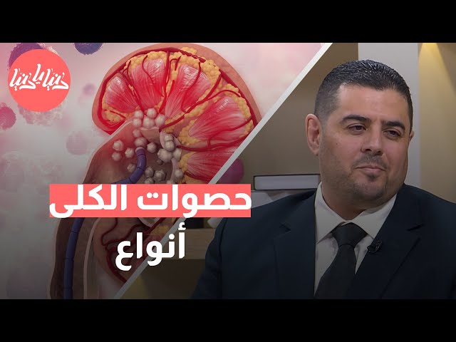 متى تجرى عمليات تفتيت حصى الكلى؟ وهل هناك بديل للجراحة؟