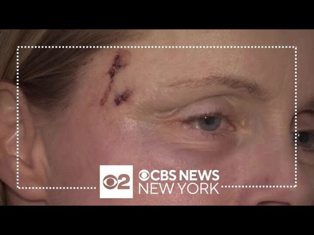 Another badly injured victim in 34th Street New Year's rampage speaks out