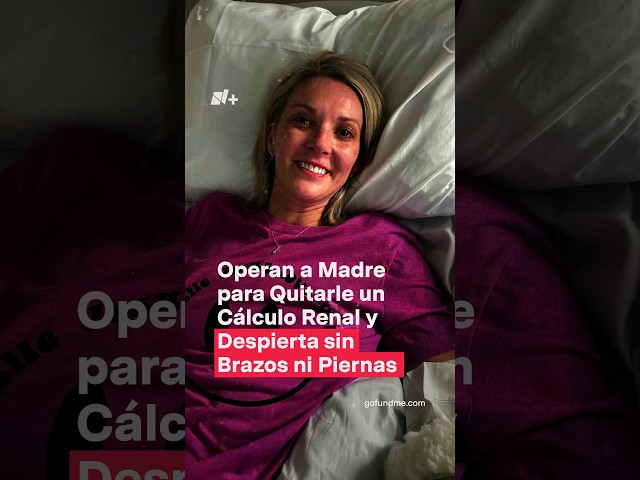 Operan a madre para quitarle un cálculo renal y despierta sin brazos ni piernas - N+ #Shorts