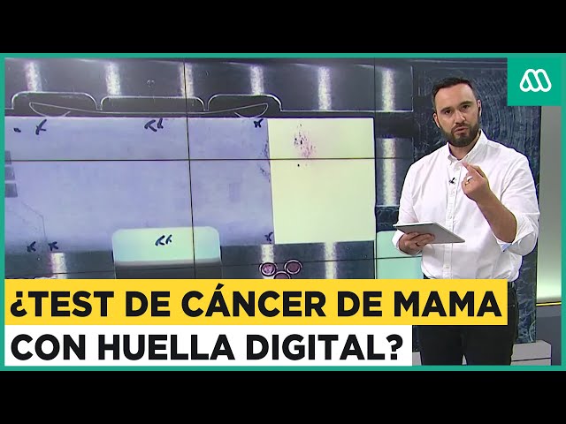 Nueva tecnología de huella digital podría reemplazar a la mamografía