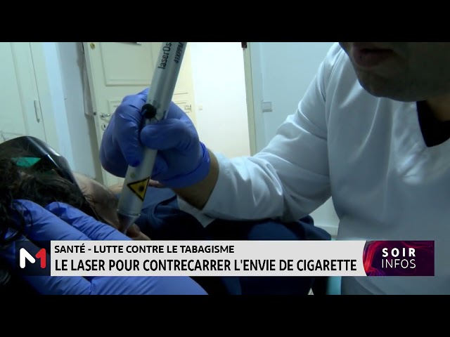 Santé-lutte contre le tabagisme : le laser pour contrecarrer l´envie de cigarette