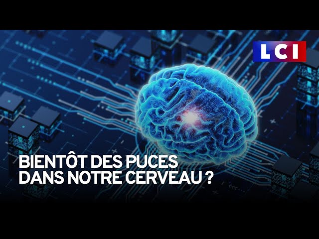 Aura-t-on bientôt des puces intégrées à notre cerveau ?