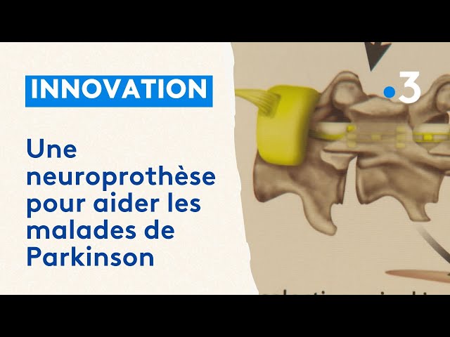 Une neuroprothèse révolutionnaire pour aider les malades de Parkinson