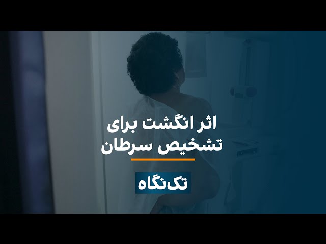 ⁣تک‌نگاه - اثر انگشت برای تشخیص سرطان