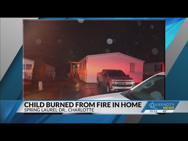 Child seriously injured after using lighter: Fire Dept.