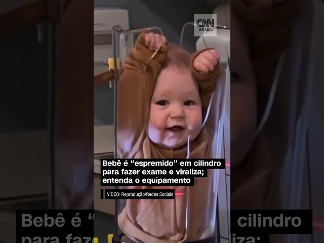 Bebê é "espremido" em cilindro para fazer exame de raio-X