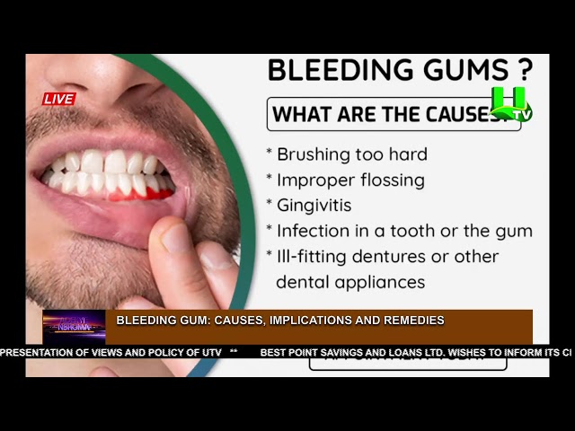 ADEKYE NSROMA: BLEEDING GUM 17/01/24