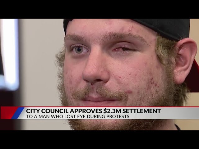 Denver council approves $2.3M settlement for protester who lost eye