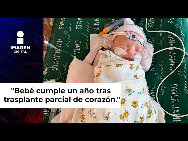 Bebé recibió un trasplante parcial de corazón al nacer... y ahora, ya tiene un año de vida