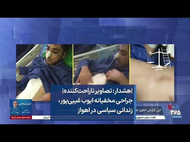 |هشدار: تصاویر ناراحت‌کننده| جراحی مخفیانه ایوب غیبی‌پور، زندانی سیاسی در اهواز