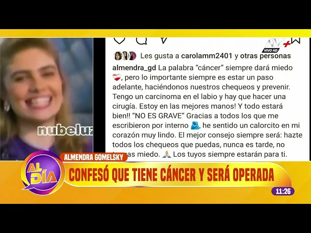 Almendra Gomelsky reveló que tiene cáncer y será sometida a delicada operación