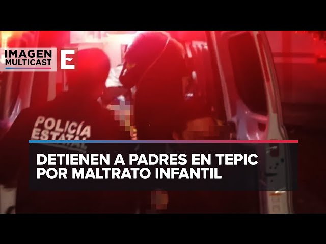 Nayarit: A niño le queman sus manos como "castigo" por portarse mal