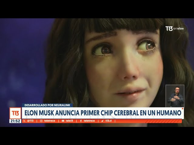 Elon Musk anuncia primer chip cerebral en un humano