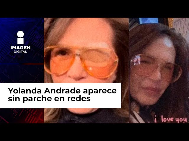 Yolanda Andrade aparece en redes sociales sin parche en el ojo; fans se alegran