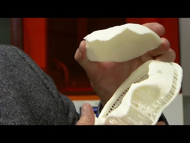 Un cráneo impreso en 3D salva la vida a un niño de 10 años