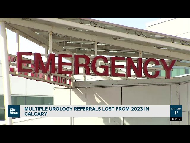 Multiple urology referrals lost from 2023 in Calgary