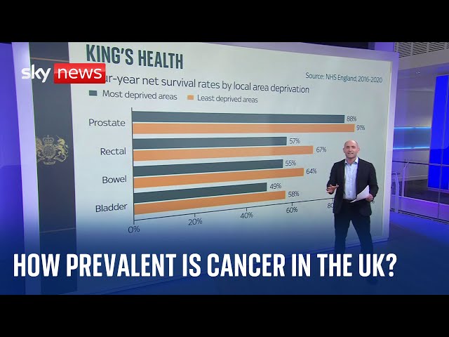 How prevalent is cancer in the UK, and what are the most common types to be diagnosed with?