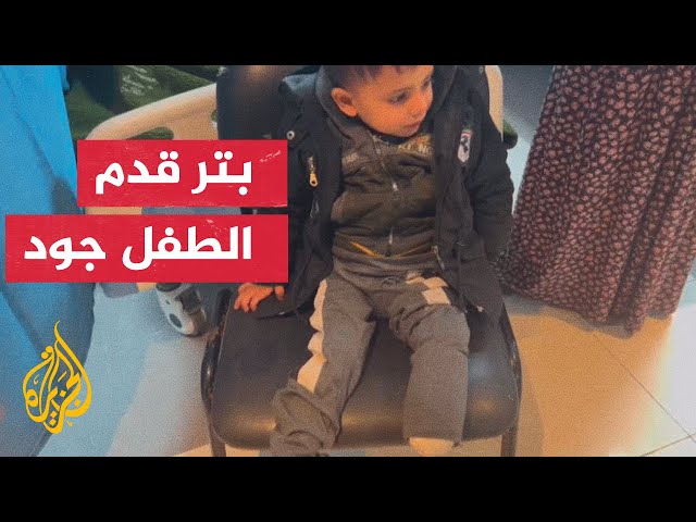 معاناة الأطفال الفلسطينيين المصابين في القصف الإسرائيلي تتفاقم مع صعوبة الحصول على علاج لهم