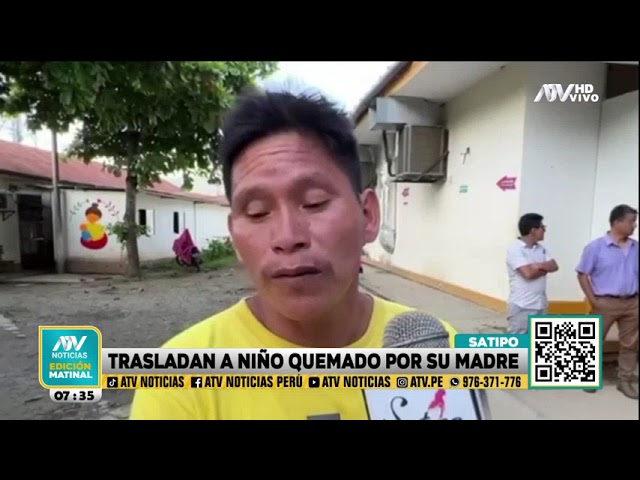 Niño quemado con agua hirviendo por su propia madre es trasladado a Lima