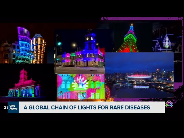 A global chain of lights for rare diseases