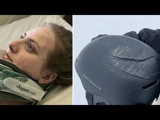 Woman on her recovering life-changing ski accident | Helmet saves woman's life