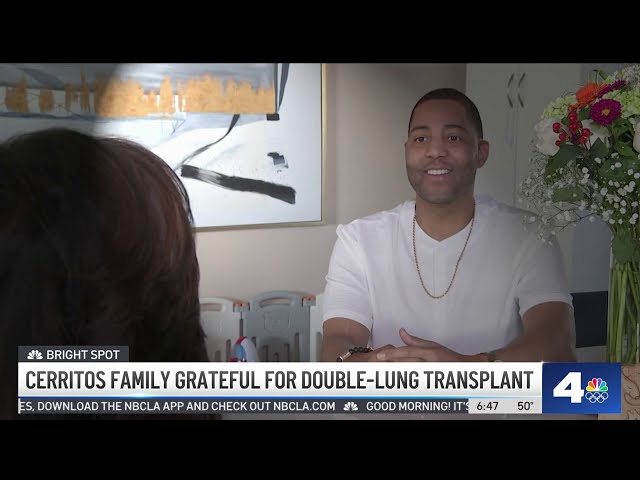 Cerritos family grateful for double-lung transplant