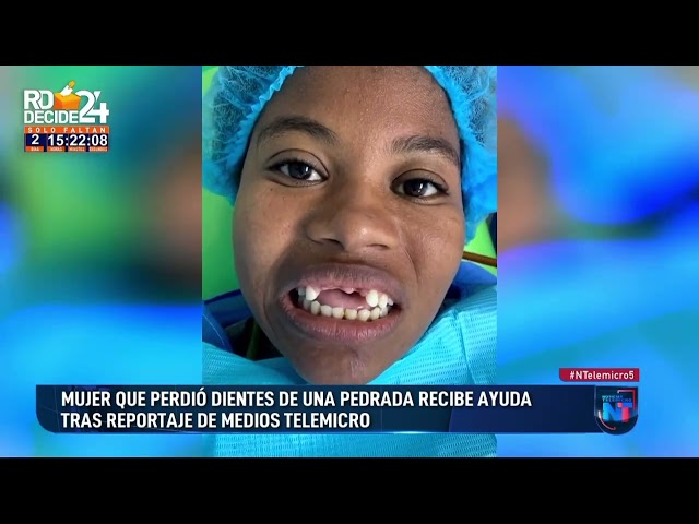 Mujer a quien muda le propinó una pedrada recibe nueva dentadura