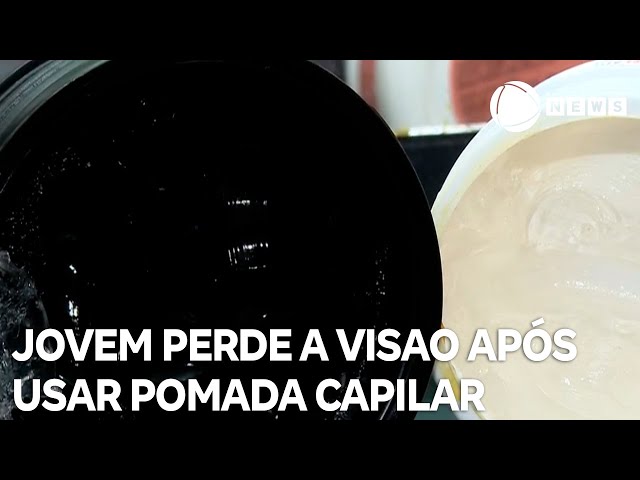 Pomadas capilares voltam a causar queimaduras e cegueira em jovens