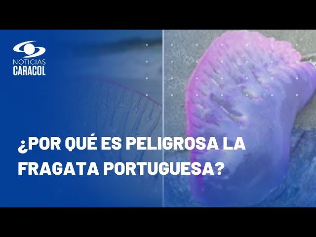 ¿Qué hacer si le pica una fragata portuguesa? Consejos para evitar riesgo en playas de San Andrés