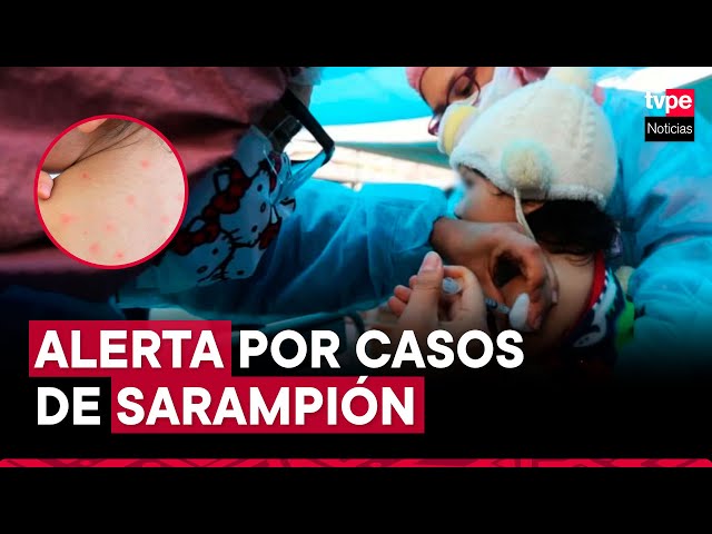 ¿Rebrote de sarampión? Ministerio de Salud vacunará a bebés a nivel nacional