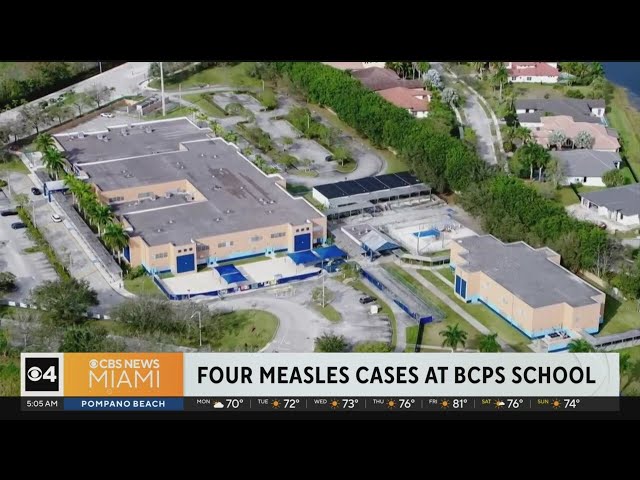 Four cases of measles at Weson elementary school