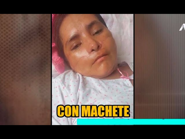 Mujer pide justicia tras sobrevivir a machetazos de expareja que recibió 5 años de cárcel