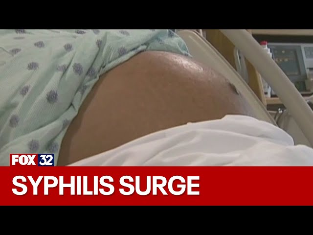 U.S. women giving birth now 3 times as likely have syphilis