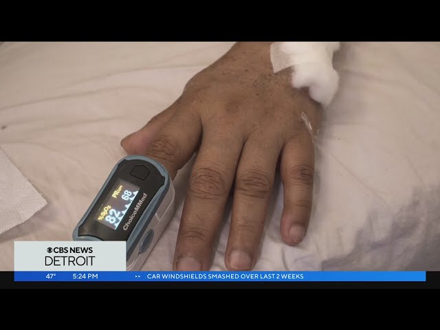 Health experts analyze pulse oximeters and how it could impact readings based on skin tone