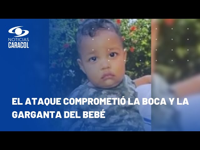 Bebé de un año murió por ataque de un perro con el que jugaba en su casa