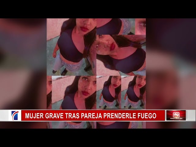 Mujer grave tras pareja prenderle fuego