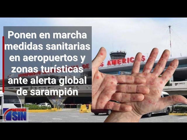 Ponen en marcha medidas sanitarias en aeropuertos y zonas turísticas ante alerta global de sarampión