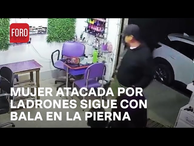 Mamá de niño que enfrentó a ladrones sigue con bala en pierna por peritajes - Las Noticias